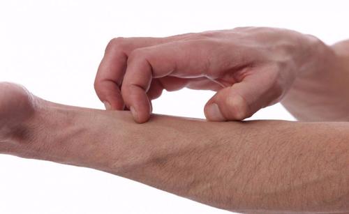 皮肤瘙痒患者生活中应当注意哪些事项有助于缓解呢?